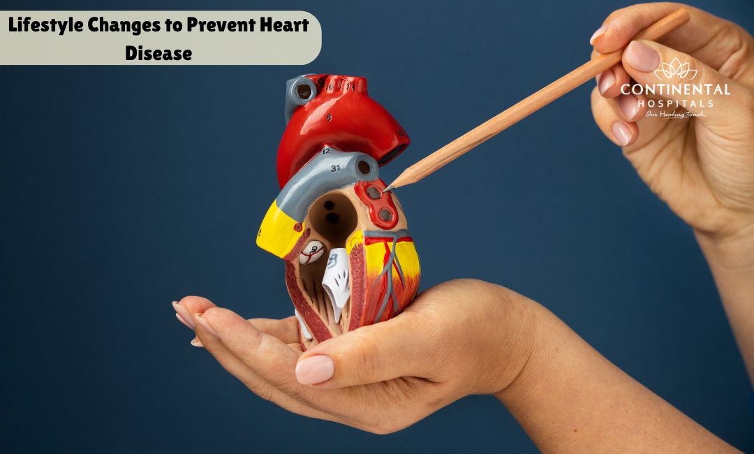 Lifestyle Changes to Prevent Heart Disease What Lifestyle Changes Can Prevent Heart Disease Naturally